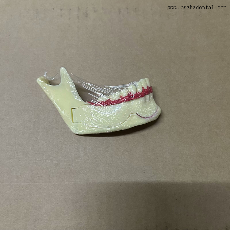Mandibular decomposition model-1 نموذج تحلل الفك السفلي-1