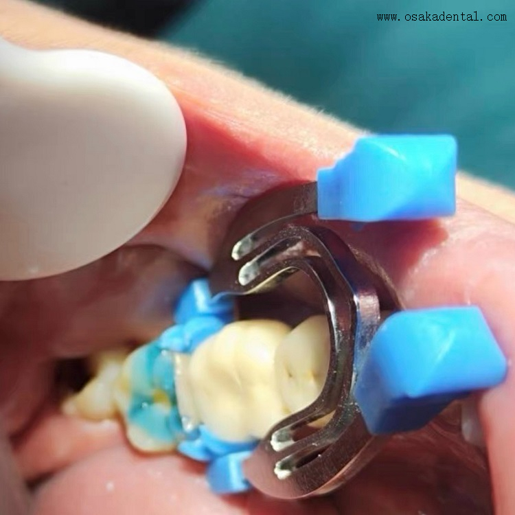 QQ图片20240531105310 كيو كيو الصورة 20240531105310