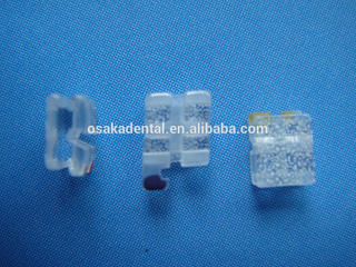 قوس تقويم الأسنان الياقوت مطاطا