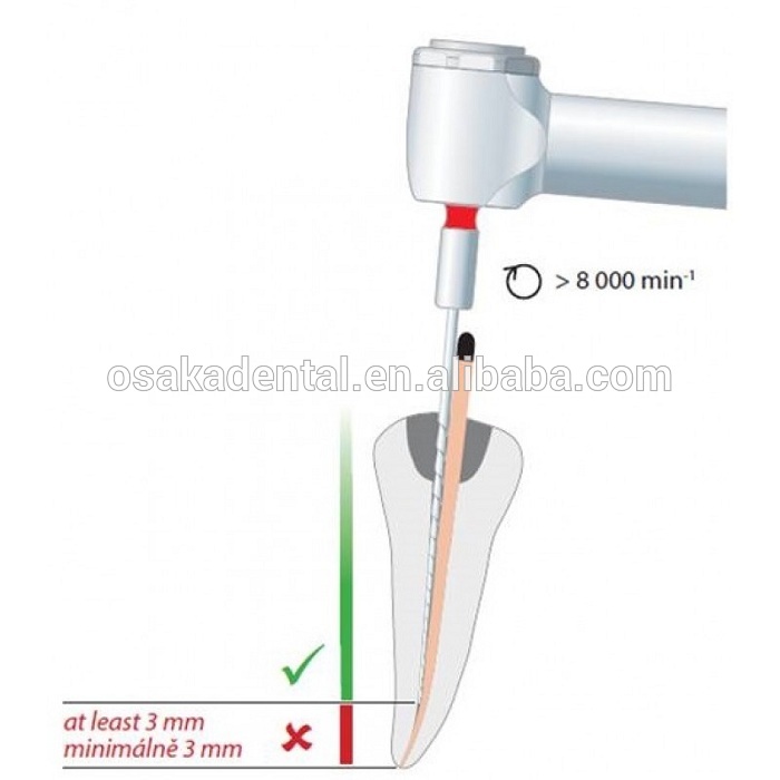 ملفات الأسنان Endo ملفات مكثف Gutta