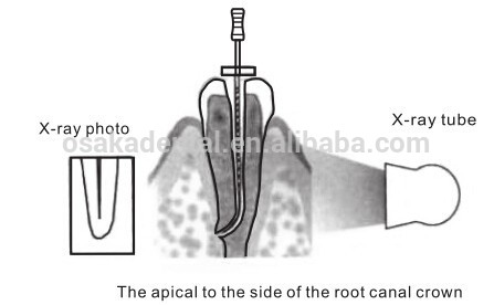دقة عالية OSAKA Dental Apex Locator لجذر الرأس