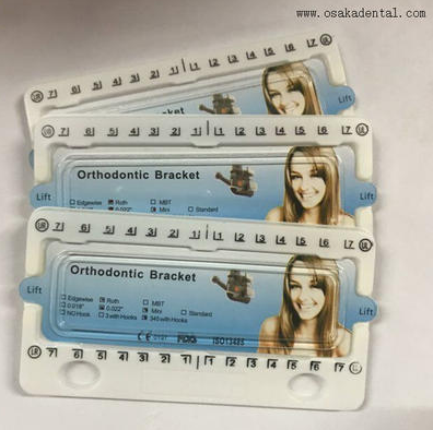 ما هو علاج تقويم الاسنان؟