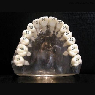 أسنان الأسنان مع المسمار لدراسة مولدي OSA-Teeth-N