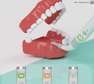 جهاز كشف زرع الأسنان لتحديد موقع مسامير الزرع