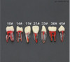 ممارسة نموذج الأسنان لاستخدام الطالب طبيب الأسنان