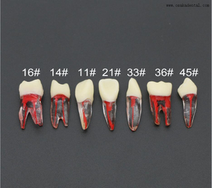 طلاب طبيب الأسنان تدريس الممارسة الراتنج نموذج لشكل الأسنان