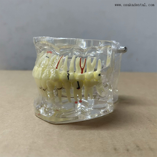 نموذج أمراض الأسنان لتدريس طبيب الأسنان