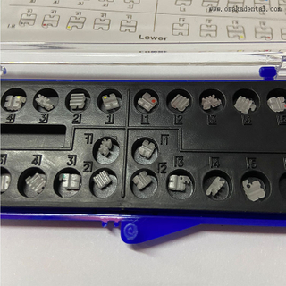 قوس السيراميك الاقتصادي لتقويم الأسنان