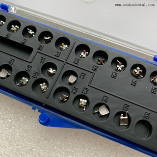 قوس تقويم الأسنان اللاصق للبالغين