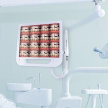 الكاميرا داخل الأسنان والشاشة مع واي فاي كرسي طب الأسنان