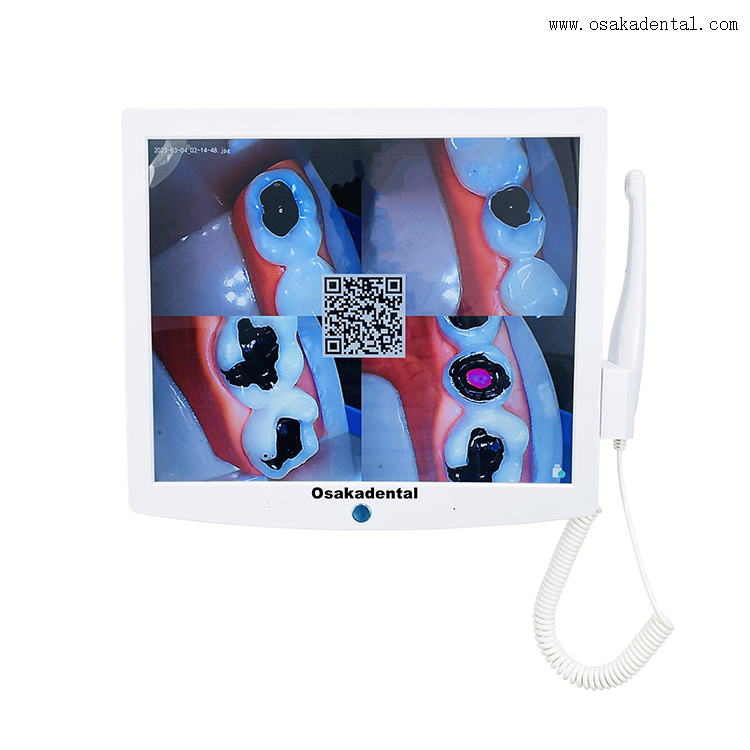 مراقب كرسي الأسنان بكاميرا عن طريق الفم