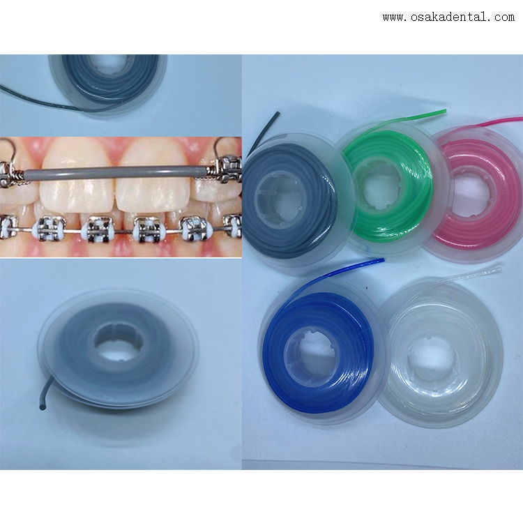 كم تقويم الأسنان بسلك قوسي