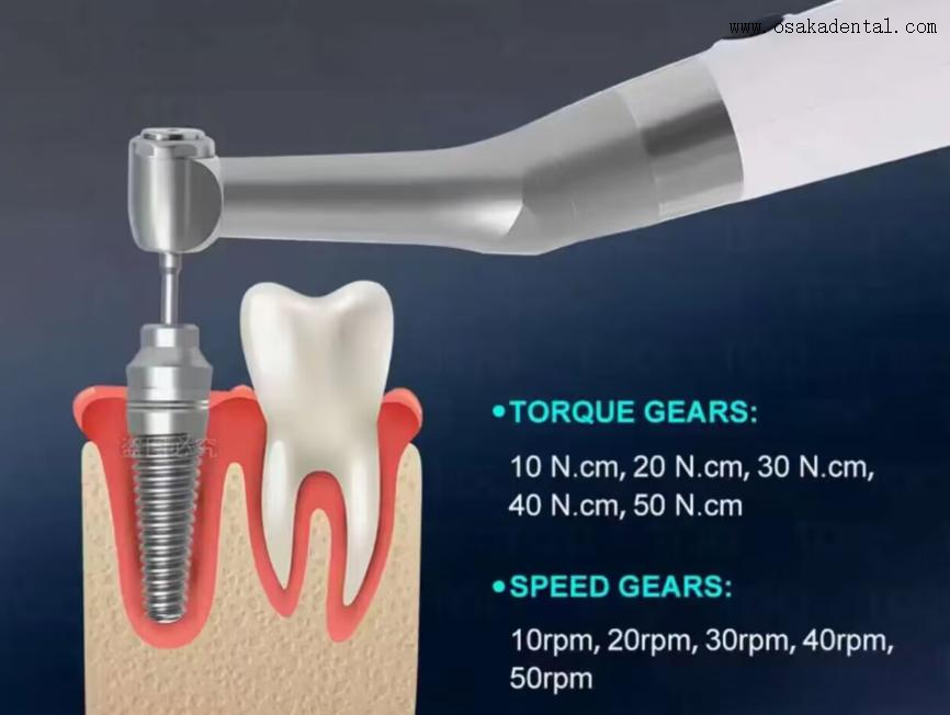 مفتاح زرع الأسنان الكهربائي